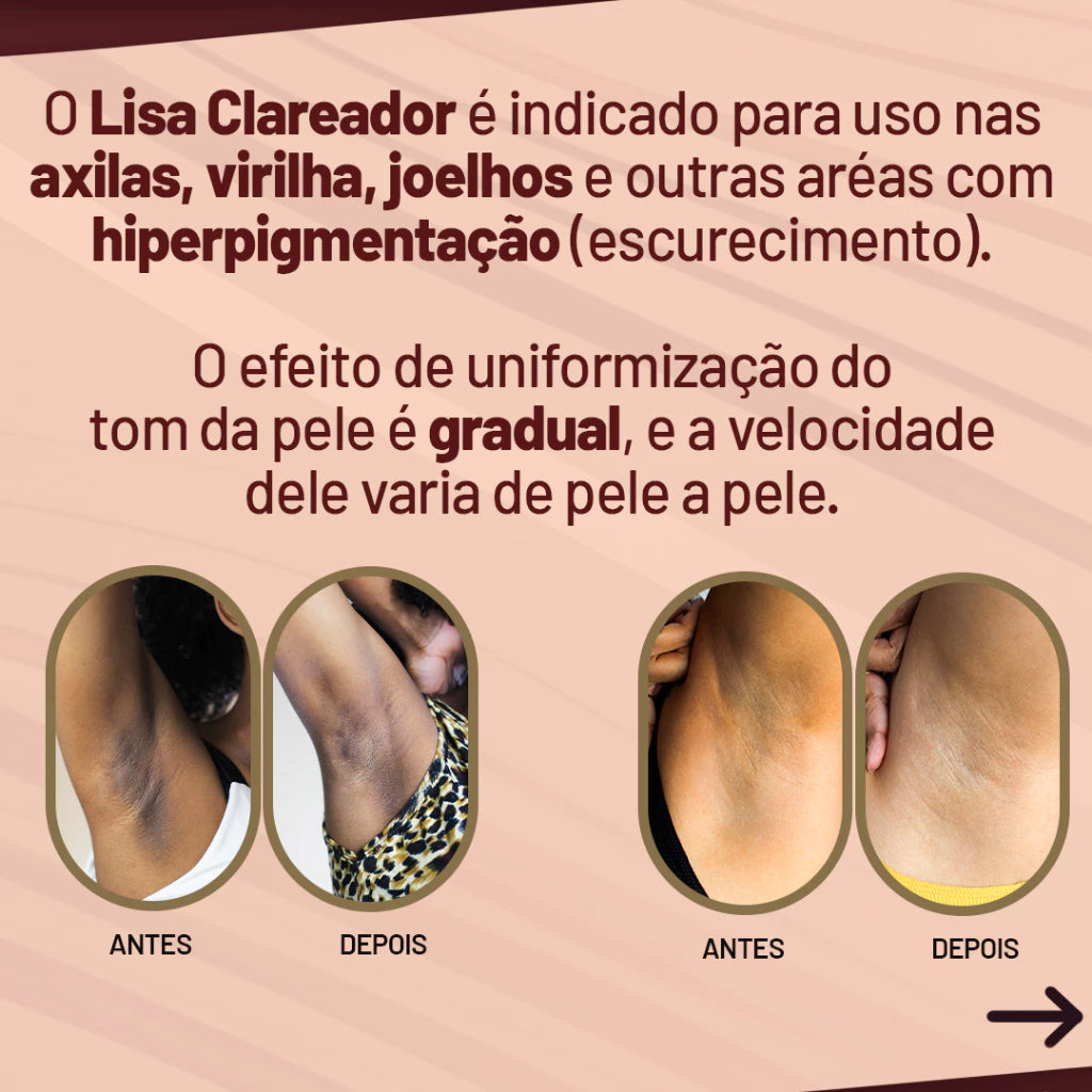 Kit Bumbum Lisinho + Creme Clareador