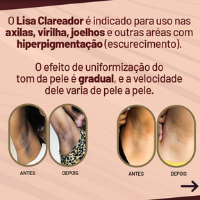 Kit Bumbum Lisinho + Creme Clareador